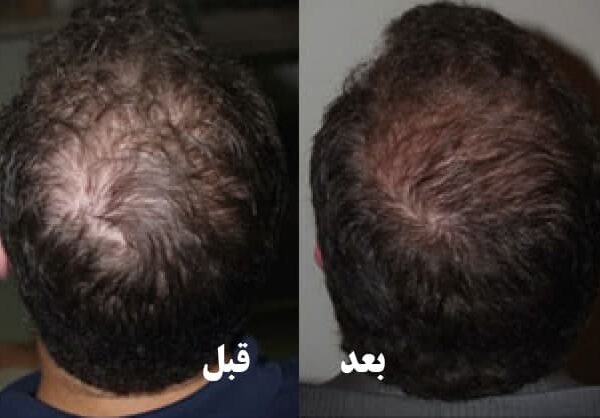 photo_2020-11-08_12-01-17