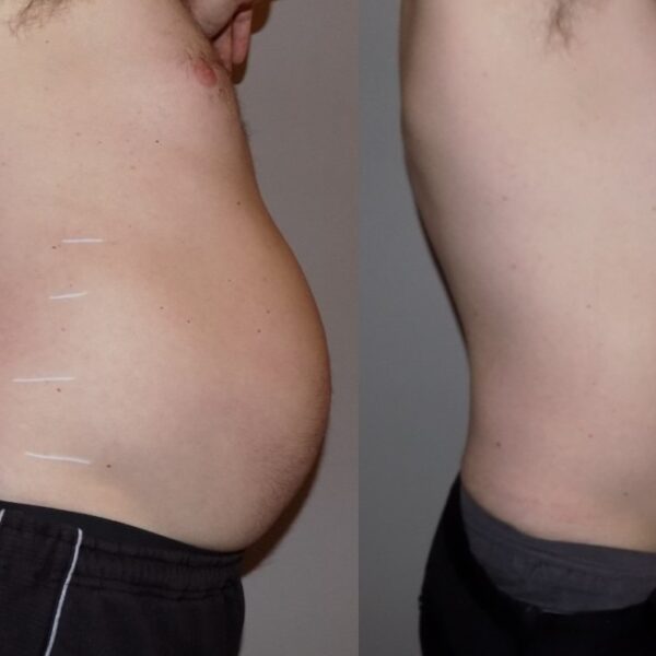 بادی-اسکالپتر